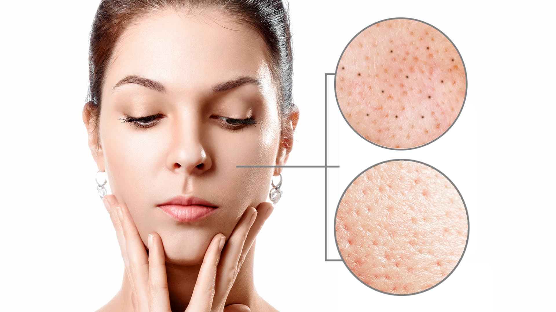 Siyah Nokta mı, Sebaceous Filaments mi? Gözenek Sıkılaştırma ve Temizleme Rehberi