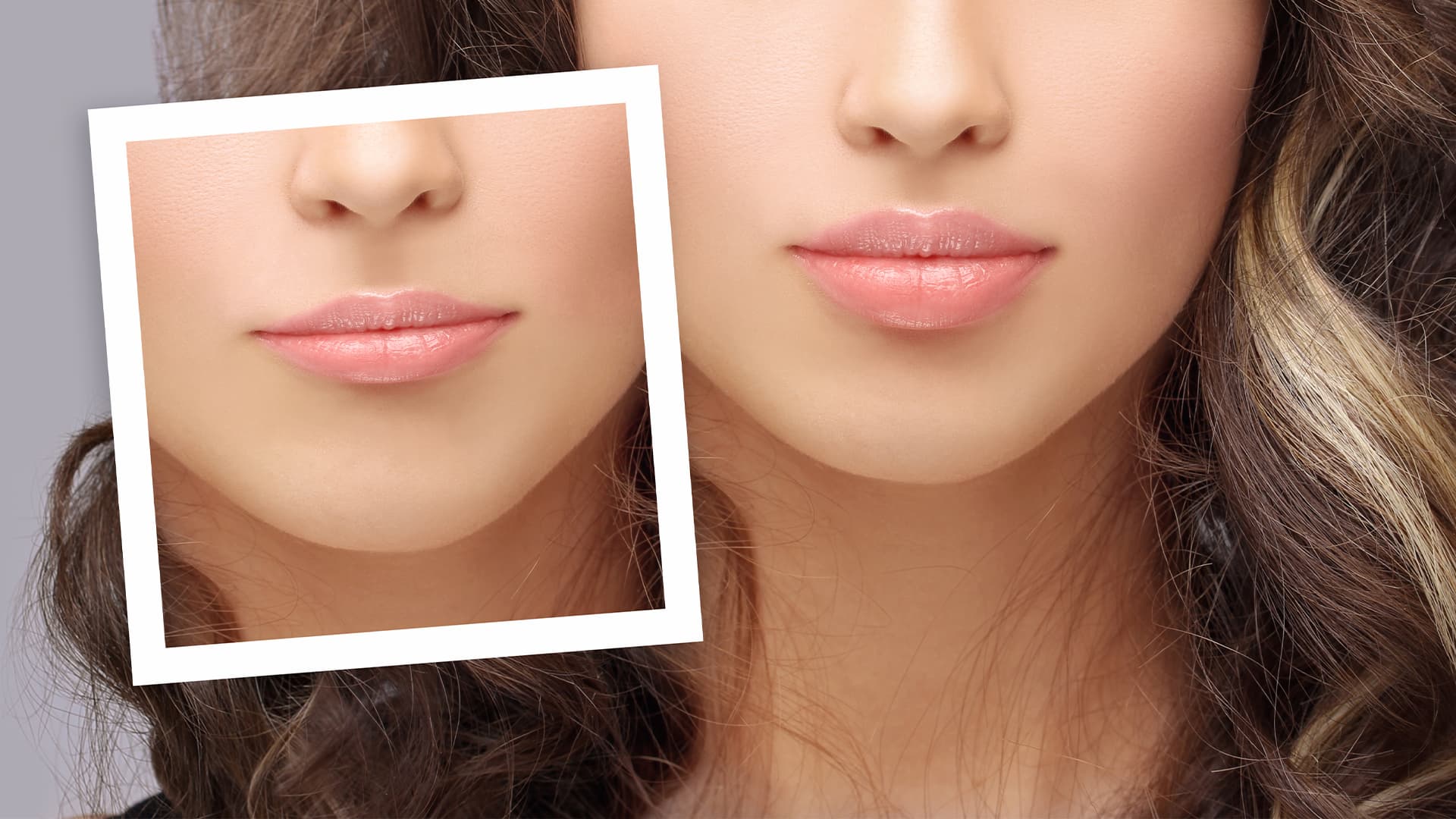 Acısız ve İğnesiz Dudak Dolgunlaştırma Yöntemleri