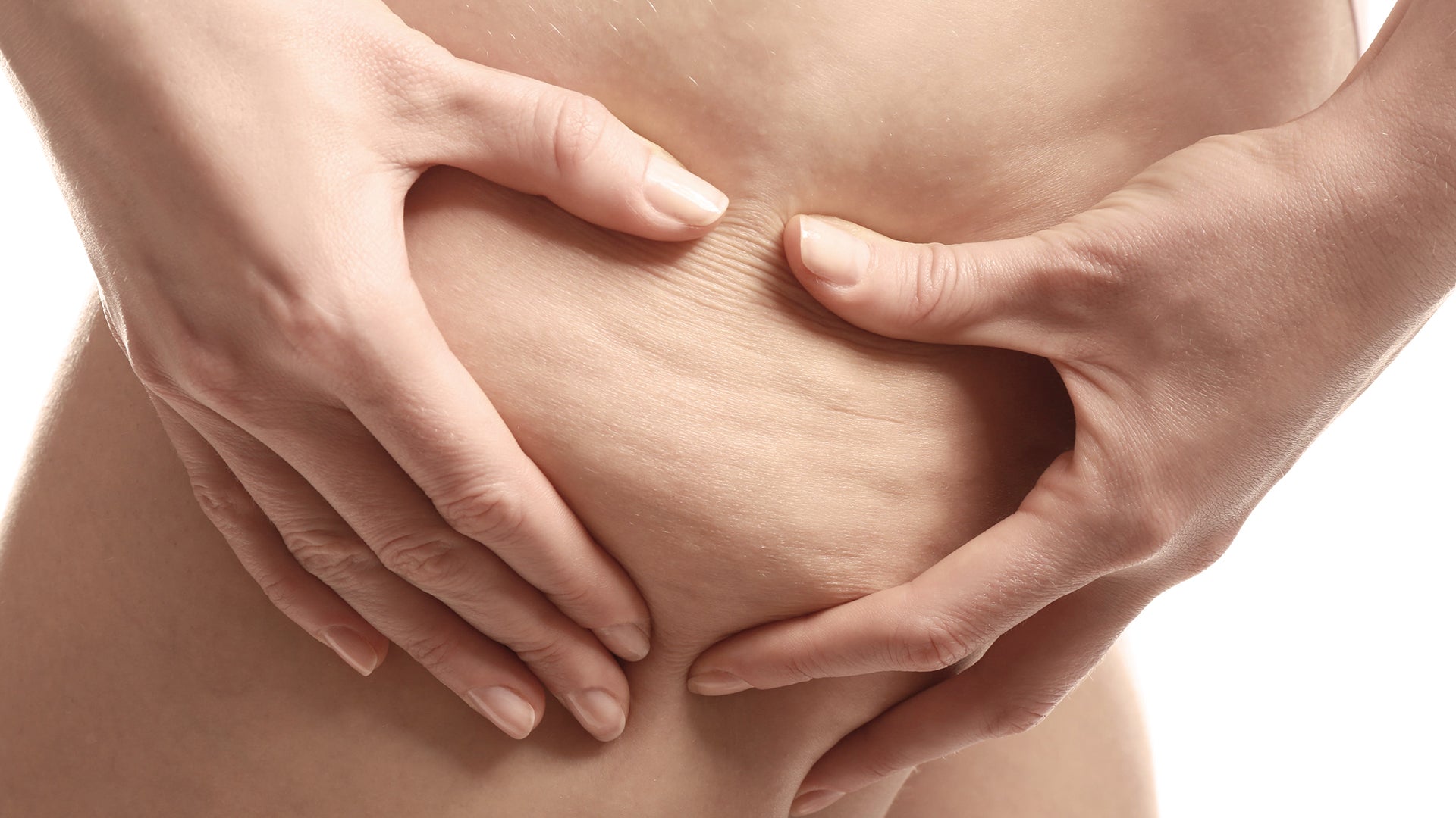 Selülit Nedir ve Nasıl Oluşur? En Etkili Selülit Giderici Yöntemler